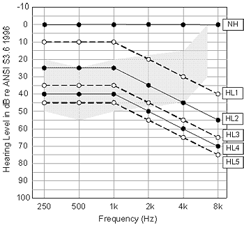 Hearing Loss Severity Chart